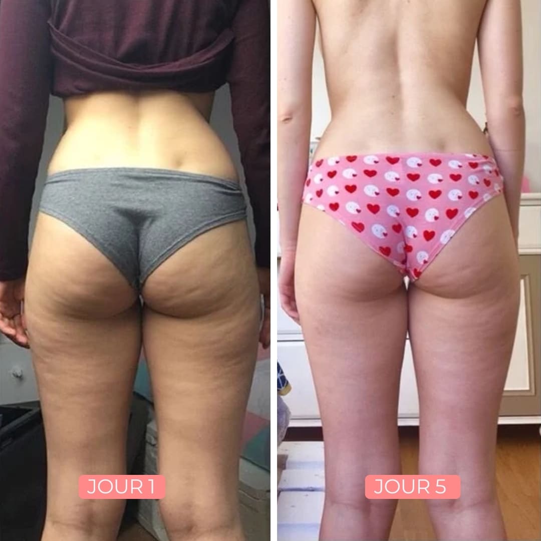 B-Smooth Lift & Firm Booty Cream Abo